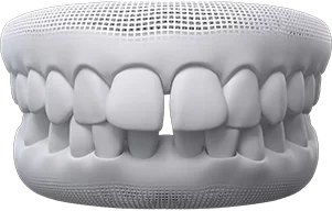 gaps