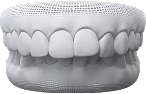overbite
